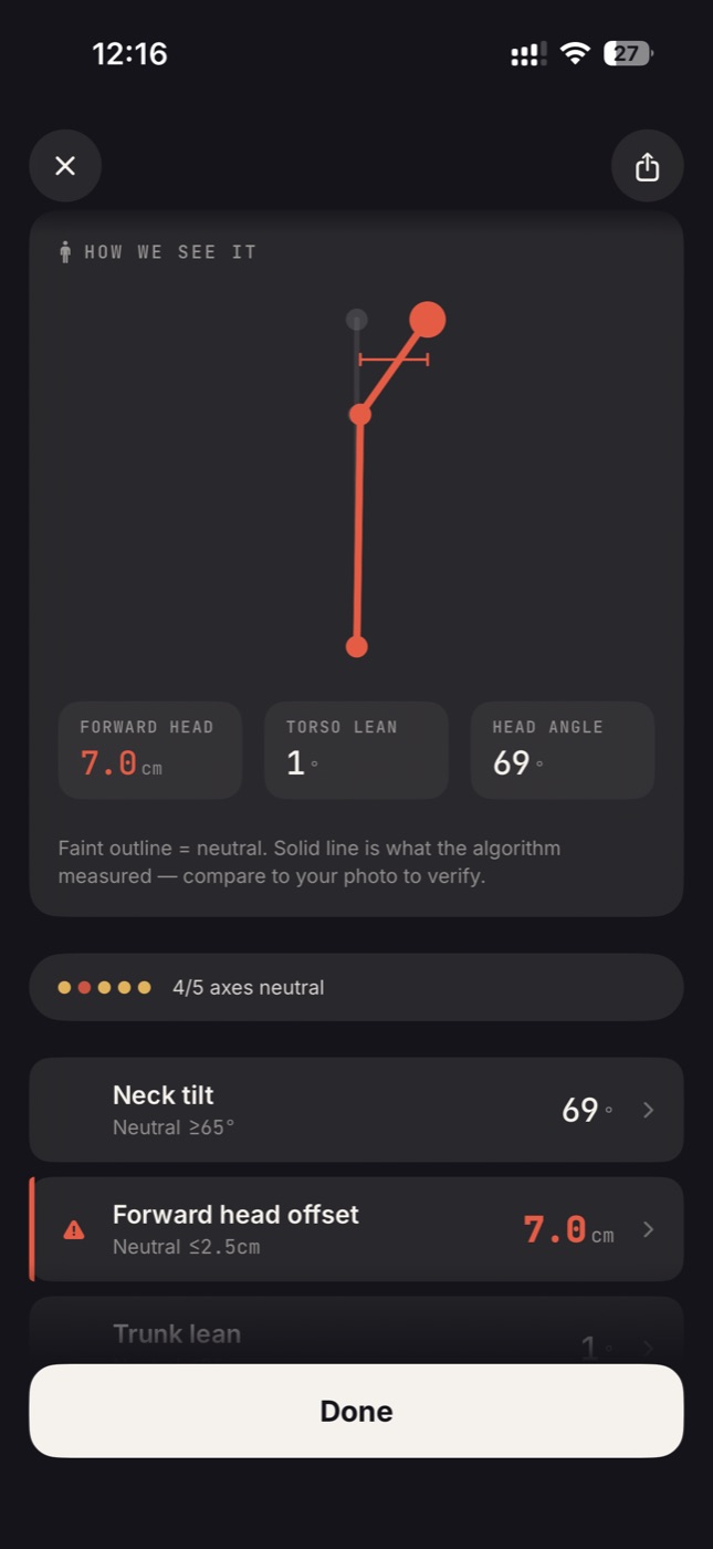 AI insight card: plain-language summary of forward head offset and what it means for daily load